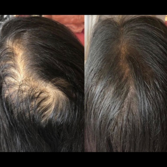 Rejuva advanced hair growth butter - Picture 2 of 3